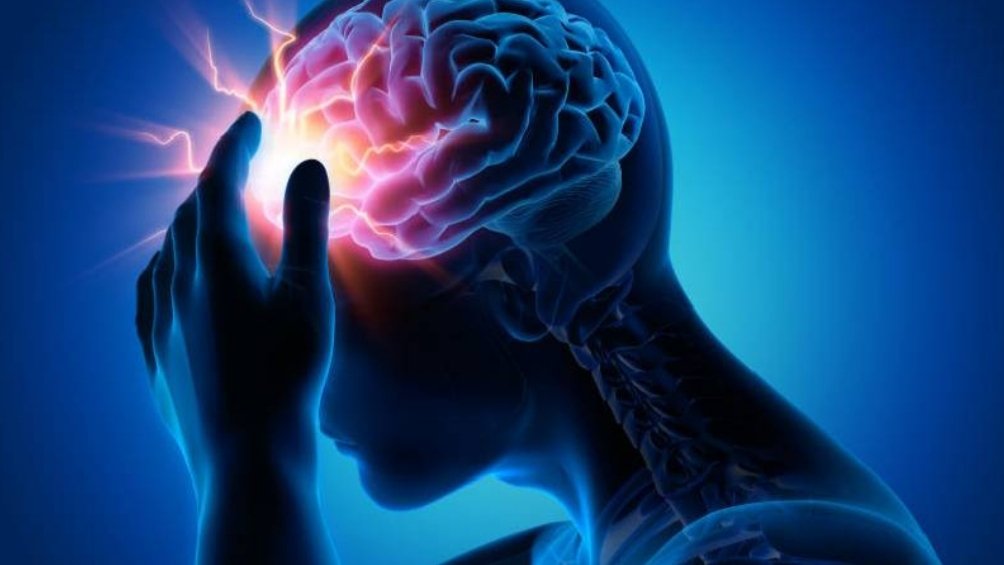 Stroke Rising Across Age Groups as Doctors Stress Fast Response