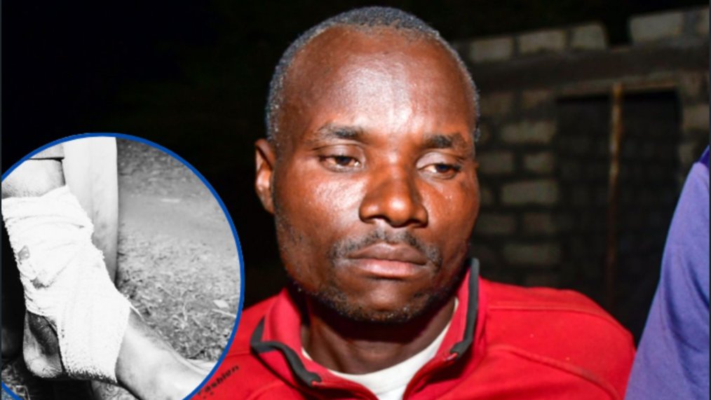 David Otieno Mboya seated after receiving medical attention for a gunshot wound to his left leg in Siaya County.