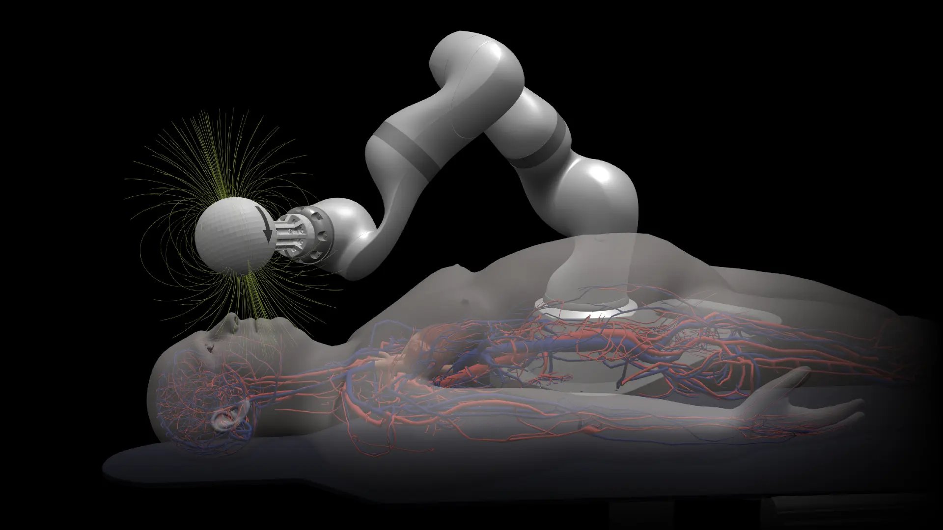 US Agency Commits $32M to Automate Stroke Intervention Robotics