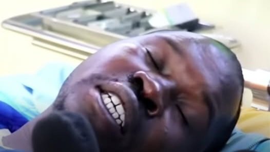 A close-up of Kabianga University student Aaron Kiprotich lying in a hospital bed while recounting the lecture hall incident.